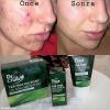Farmasi Tea Tree Oil Serum 0.33 fl. oz.