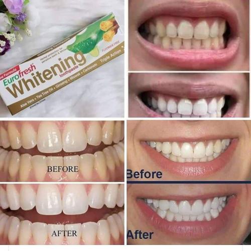 Eurofresh Whitening Toothpaste 115ml./ 3.7 fl.oz.